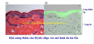 Hoạt chất Hyalo-Oligo – Bán hoạt chất dưỡng ẩm, giảm nếp nhăn Hyalo-Oligo
